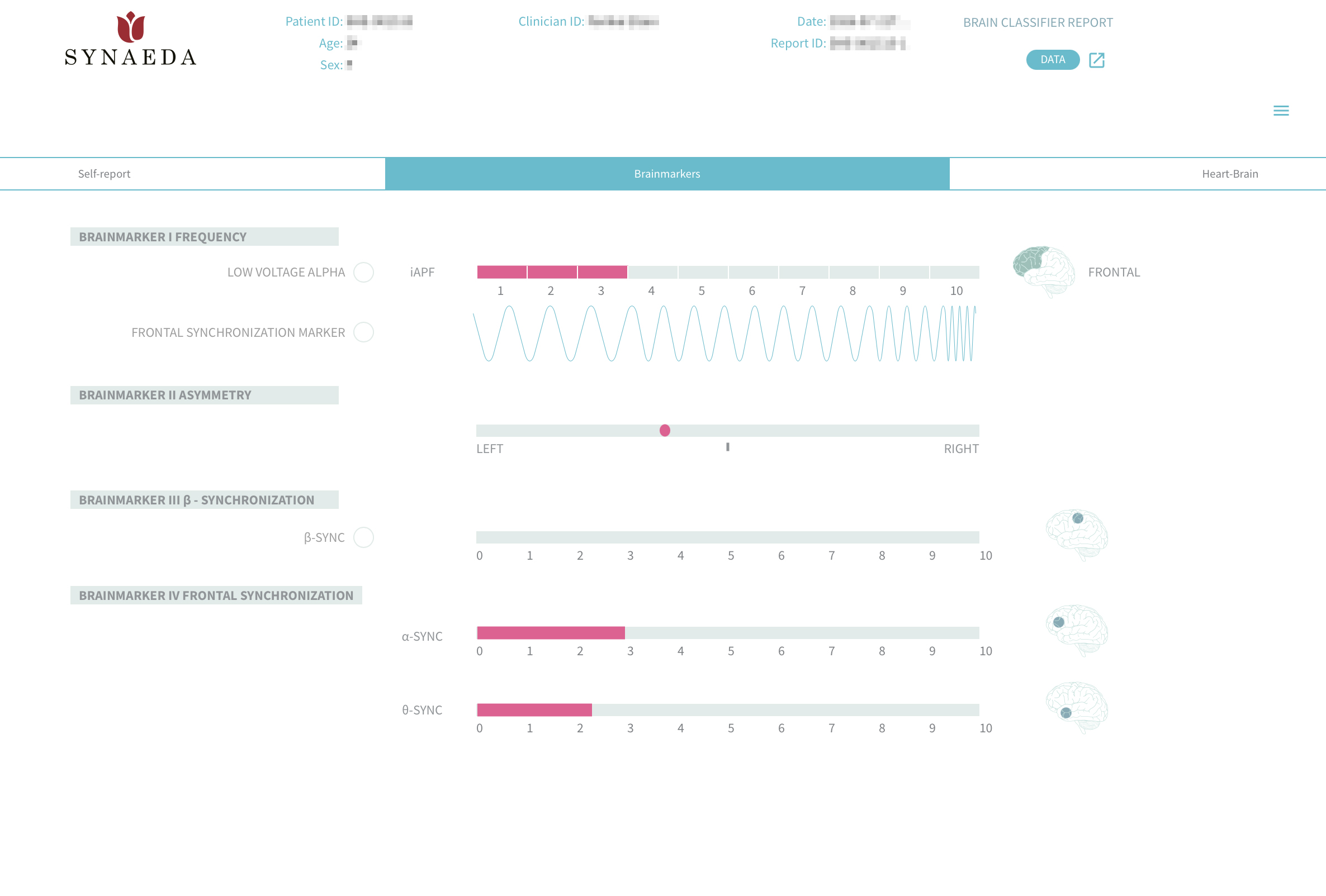 Brainmarker Suite dashboard met EEG biomarkers